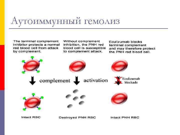 Аутоиммунный гемолиз 