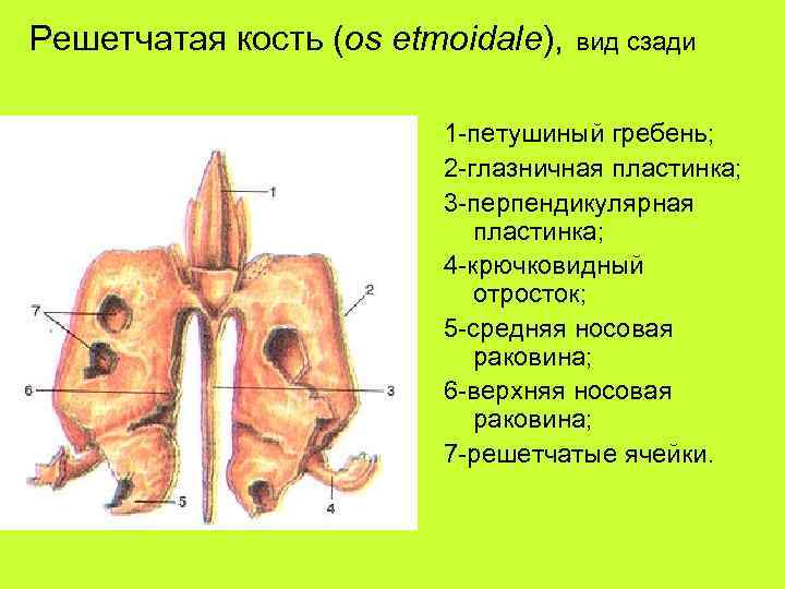 Решетчатая кость (os etmoidale), вид сзади 1 -петушиный гребень; 2 -глазничная пластинка; 3 -перпендикулярная