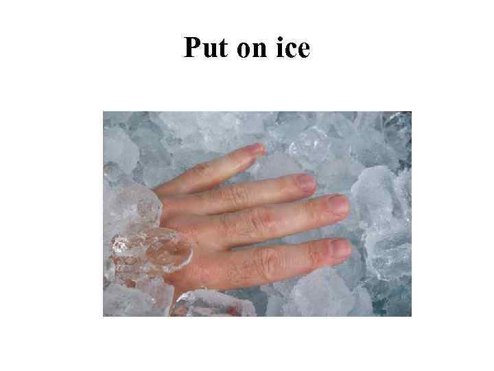 Put on ice 