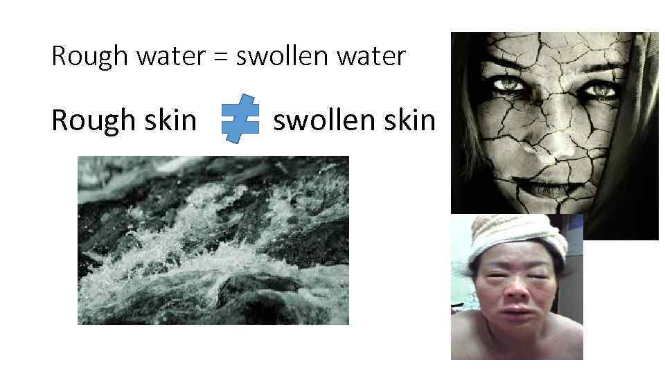 Rough water = swollen water Rough skin swollen skin 