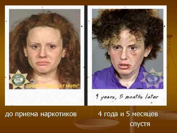 до приема наркотиков 4 года и 5 месяцев спустя 