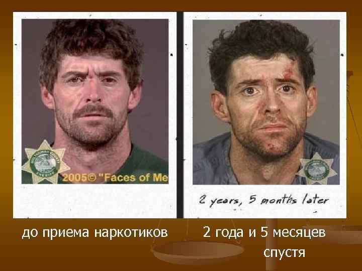 до приема наркотиков 2 года и 5 месяцев спустя 