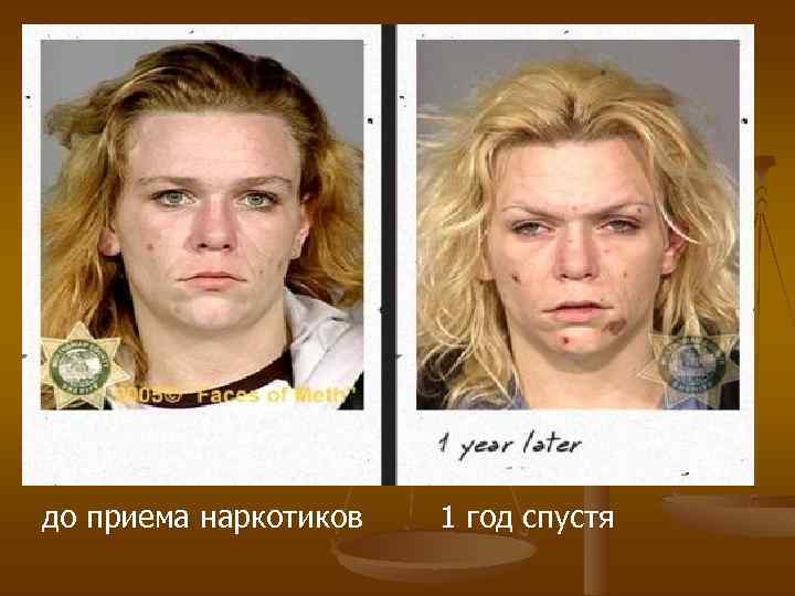 до приема наркотиков 1 год спустя 
