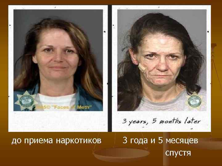 до приема наркотиков 3 года и 5 месяцев спустя 