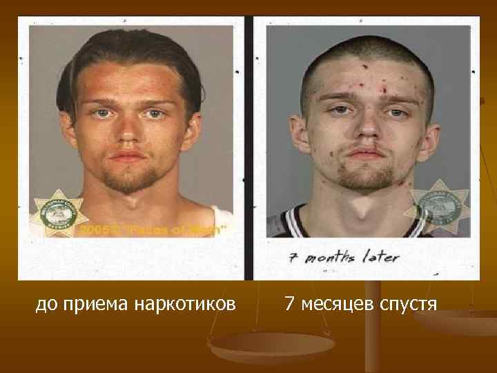 до приема наркотиков 7 месяцев спустя 