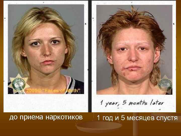 до приема наркотиков 1 год и 5 месяцев спустя 