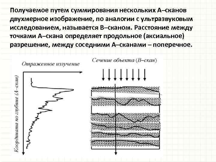Получаемое путем суммирования нескольких А–сканов двухмерное изображение, по аналогии с ультразвуковым исследованием, называется В–сканом.