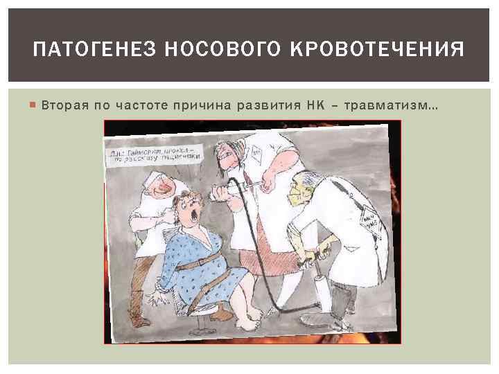 ПАТОГЕНЕЗ НОСОВОГО КРОВОТЕЧЕНИЯ Вторая по частоте причина развития НК – травматизм… 