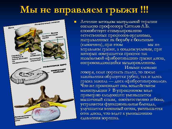 Мы не вправляем грыжи !!! n Лечение методом мануальной терапии согласно профессору Сителю А.