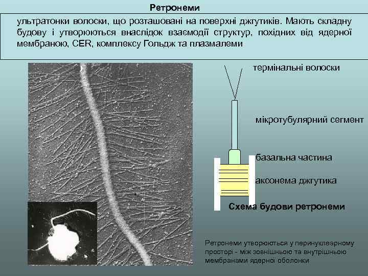 Ретронеми ультратонки волоски, що розташовані на поверхні джгутиків. Мають складну будову і утворюються внаслідок
