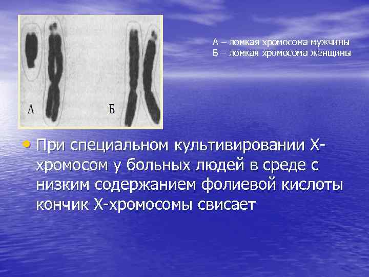 А – ломкая хромосома мужчины Б – ломкая хромосома женщины • При специальном культивировании