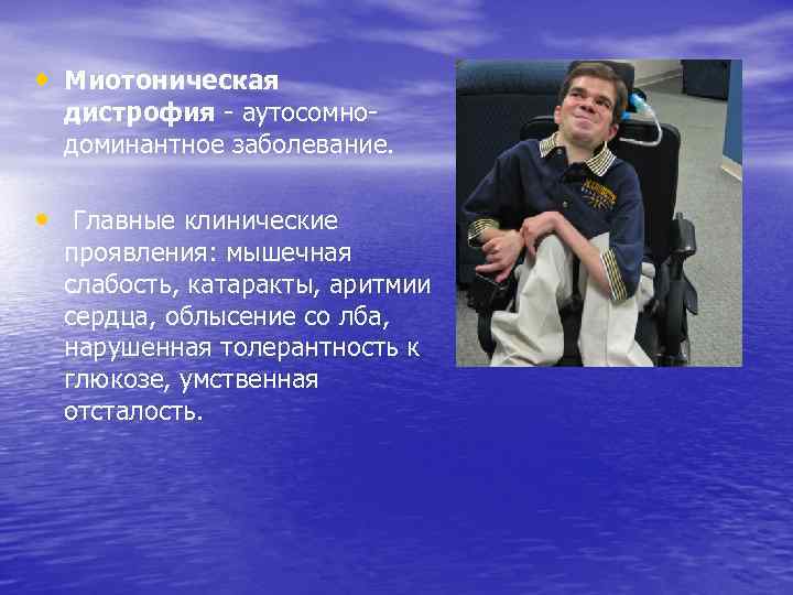  • Миотоническая дистрофия - аутосомнодоминантное заболевание. • Главные клинические проявления: мышечная слабость, катаракты,