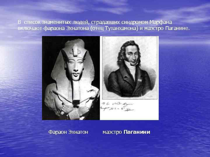 В список знаменитых людей, страдавших синдромом Марфана включают фараона Эхнатона (отец Тутанхамона) и маэстро