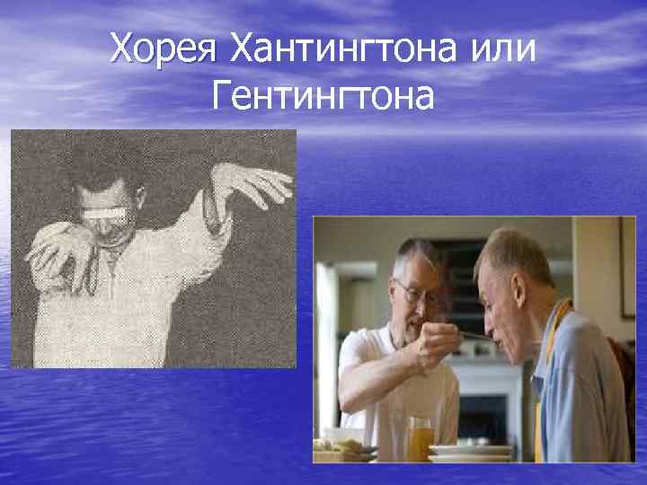Хорея Хантингтона или Хорея Гентингтона 
