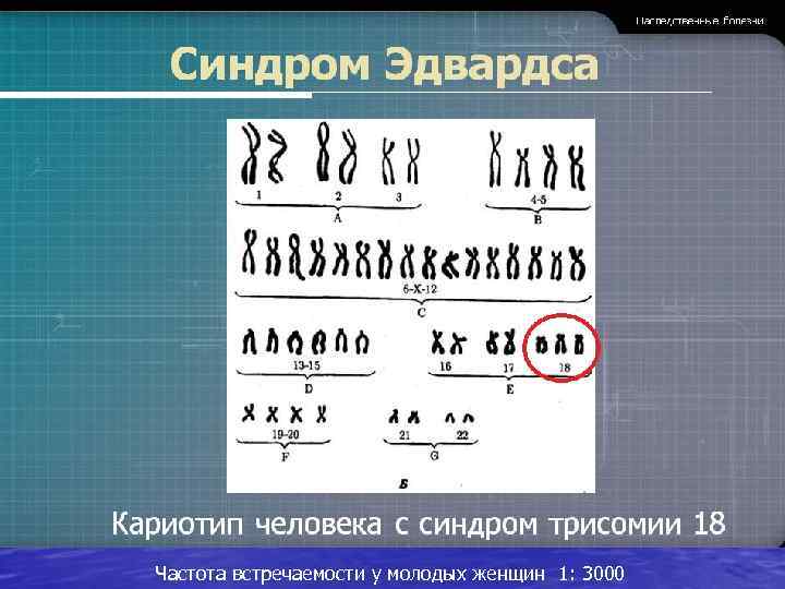 Частота встречаемости у молодых женщин 1: 3000 
