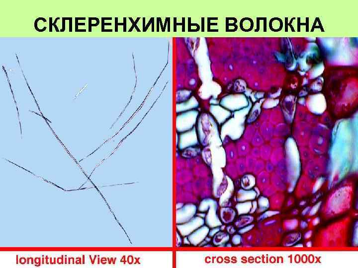 СКЛЕРЕНХИМНЫЕ ВОЛОКНА 