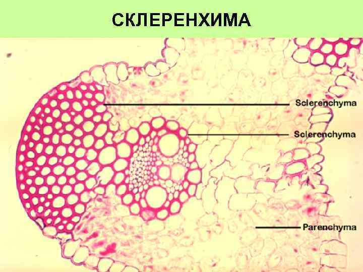 Склеренхима. Склеренхимные волокна строение. Склеренхима-механическая ткань,которая состоит из. Клетки склеренхимы. Строение склеренхимных клеток.