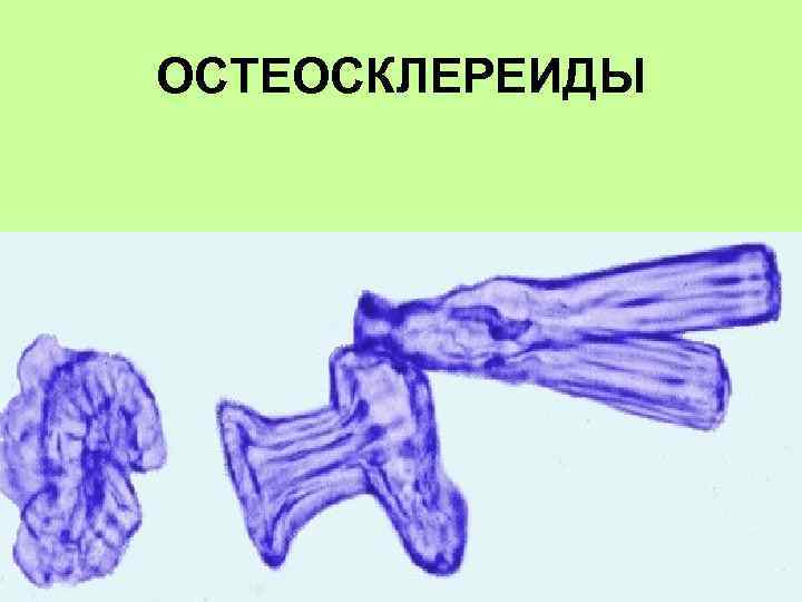 ОСТЕОСКЛЕРЕИДЫ 