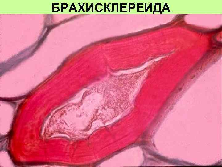 БРАХИСКЛЕРЕИДА 