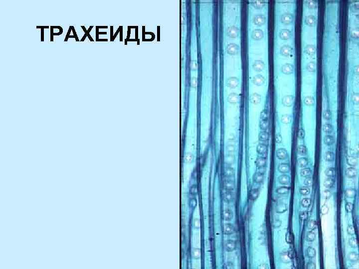 На представленном ниже рисунке зафиксированы сосуды и трахеиды ткани участвующей в важном процессе