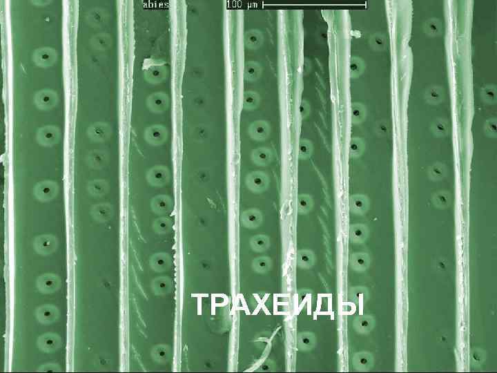 ТРАХЕИДЫ 