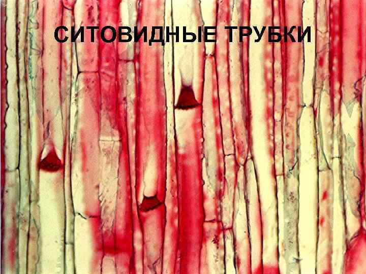 СИТОВИДНЫЕ ТРУБКИ 