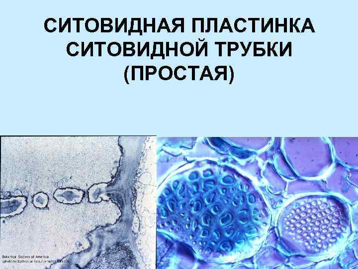 СИТОВИДНАЯ ПЛАСТИНКА СИТОВИДНОЙ ТРУБКИ (ПРОСТАЯ) 