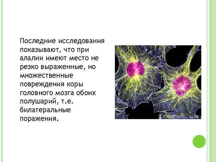 Последние исследования показывают, что при алалии имеют место не резко выраженные, но множественные повреждения