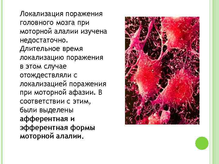 Локализация поражения головного мозга при моторной алалии изучена недостаточно. Длительное время локализацию поражения в