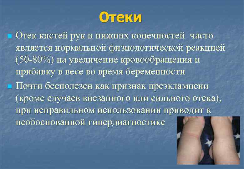 Отеки n n Отек кистей рук и нижних конечностей часто является нормальной физиологической реакцией