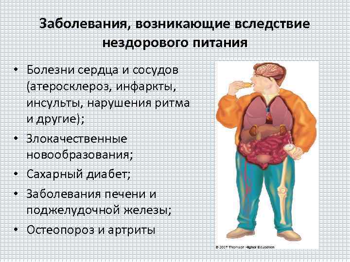 Заболевания, возникающие вследствие нездорового питания • Болезни сердца и сосудов (атеросклероз, инфаркты, инсульты, нарушения