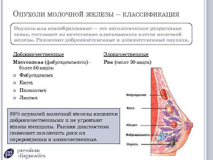 ОПУХОЛИ МОЛОЧНОЙ ЖЕЛЕЗЫ – КЛАССИФИКАЦИЯ Опухоль или новообразование — это патологическое разрастание ткани, состоящее