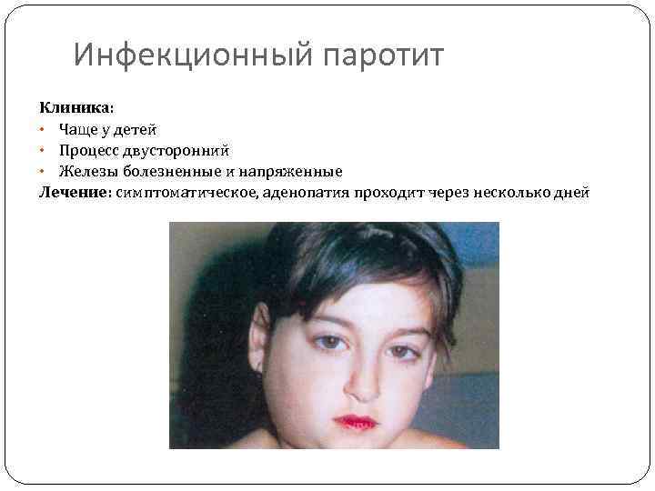 Инфекционный паротит Клиника: • Чаще у детей • Процесс двусторонний • Железы болезненные и