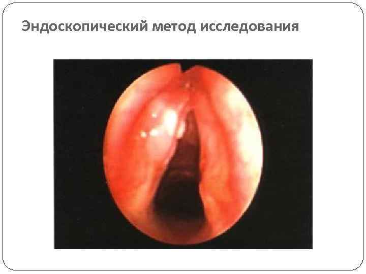 Эндоскопический метод исследования 