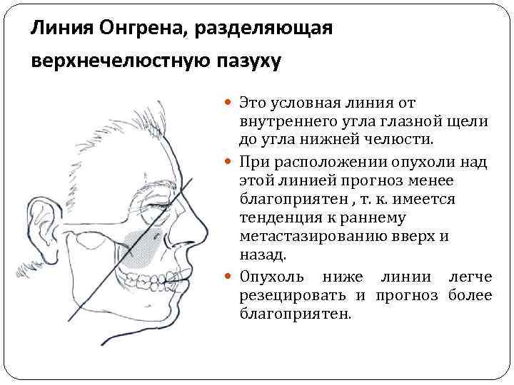 Линия Онгрена, разделяющая верхнечелюстную пазуху Это условная линия от внутреннего угла глазной щели до