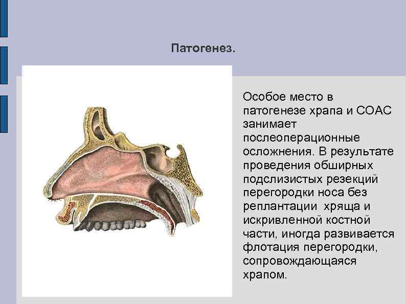 Патогенез. Особое место в патогенезе храпа и СОАС занимает послеоперационные осложнения. В результате проведения