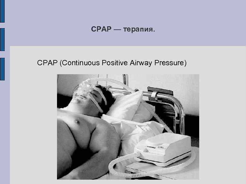 СРАР — терапия. CPAP (Continuous Positive Airway Pressure) 