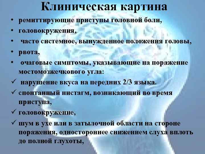 Клиническая картина • • • ремиттирующие приступы головной боли, головокружения, часто системное, вынужденное положения