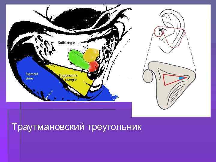 Траутмановский треугольник 