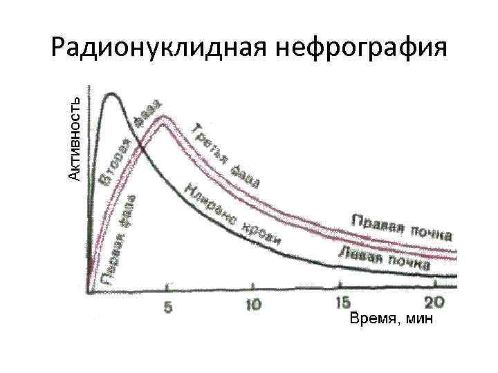 Радионуклидная нефрография 
