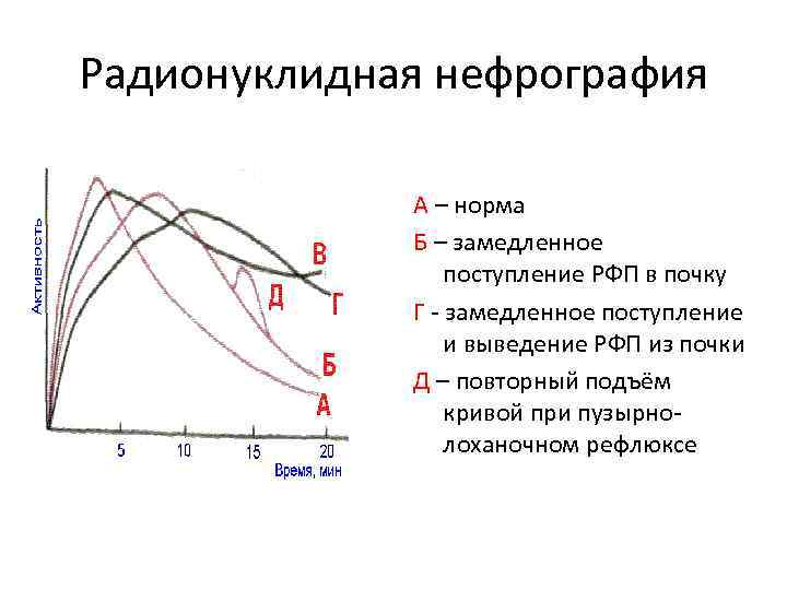Радионуклидная нефрография А – норма Б – замедленное поступление РФП в почку Г -