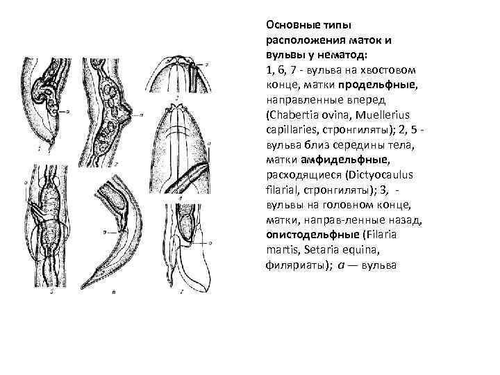 Основные типы расположения маток и вульвы у нематод: 1, 6, 7 вульва на хвостовом