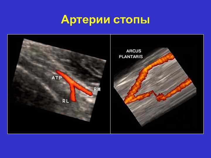 Артерии стопы 