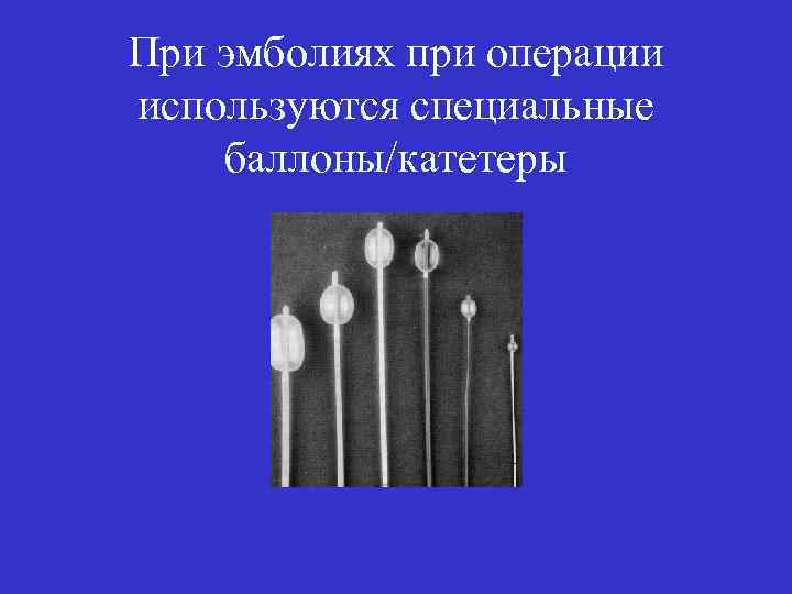 При эмболиях при операции используются специальные баллоны/катетеры 