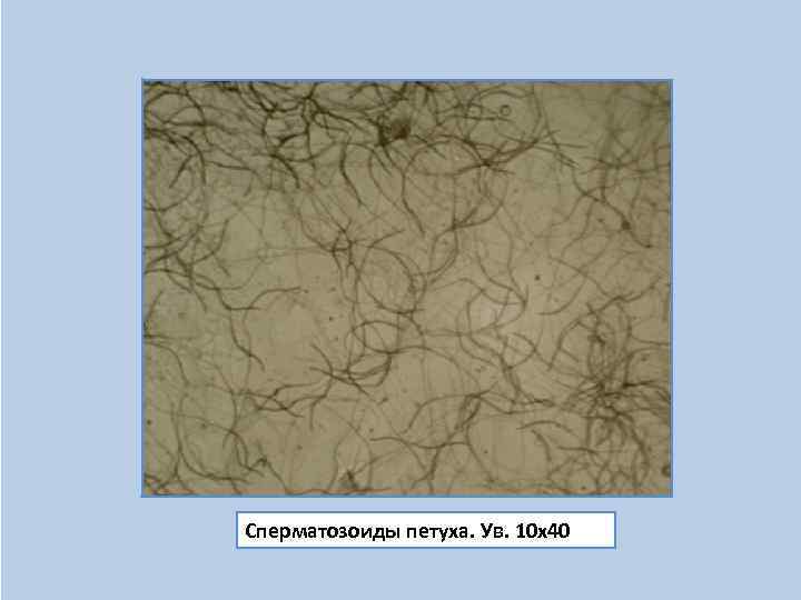 Сперматозоиды петуха. Ув. 10 х40 