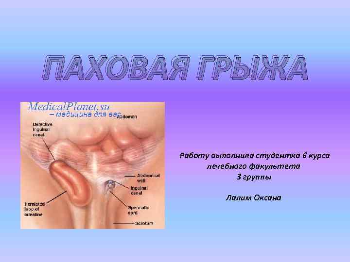 ПАХОВАЯ ГРЫЖА Работу выполнила студентка 6 курса лечебного факультета 3 группы Лалим Оксана 