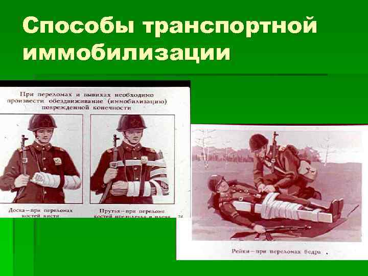 Способы транспортной иммобилизации 