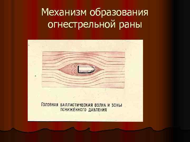 Механизм образования огнестрельной раны 
