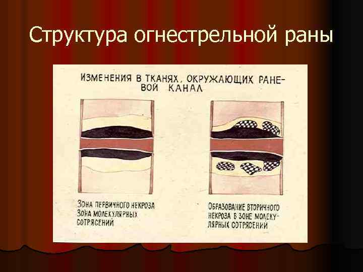 Структура огнестрельной раны 