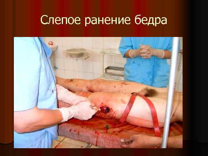 Слепое ранение бедра 